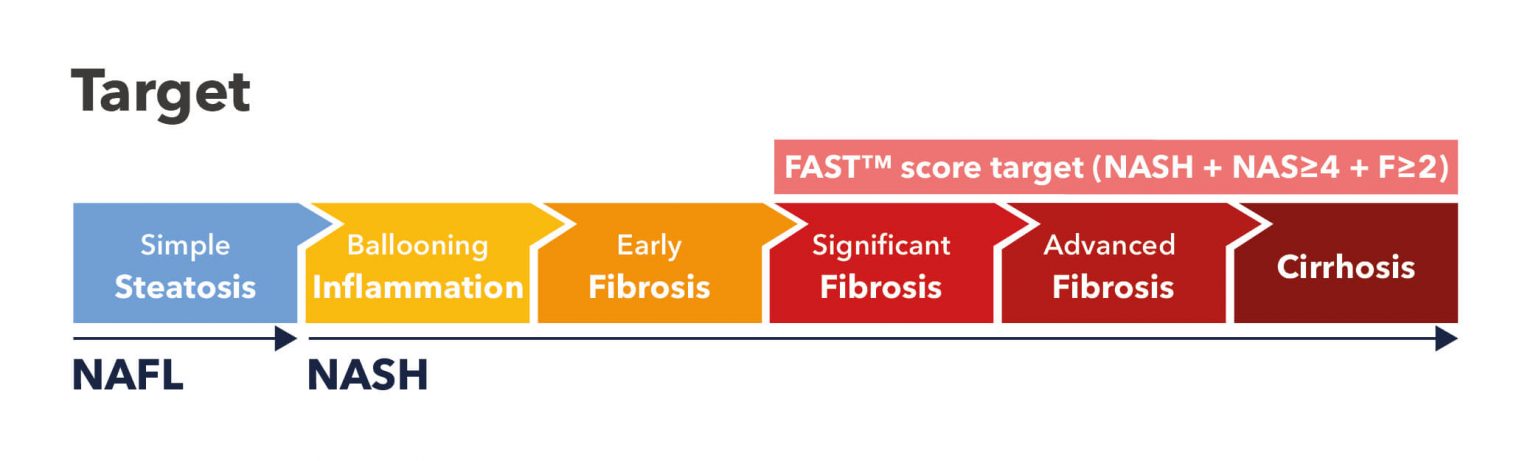 Fast Score Identify At risk NAFLD NASH Patients ECHOSENS