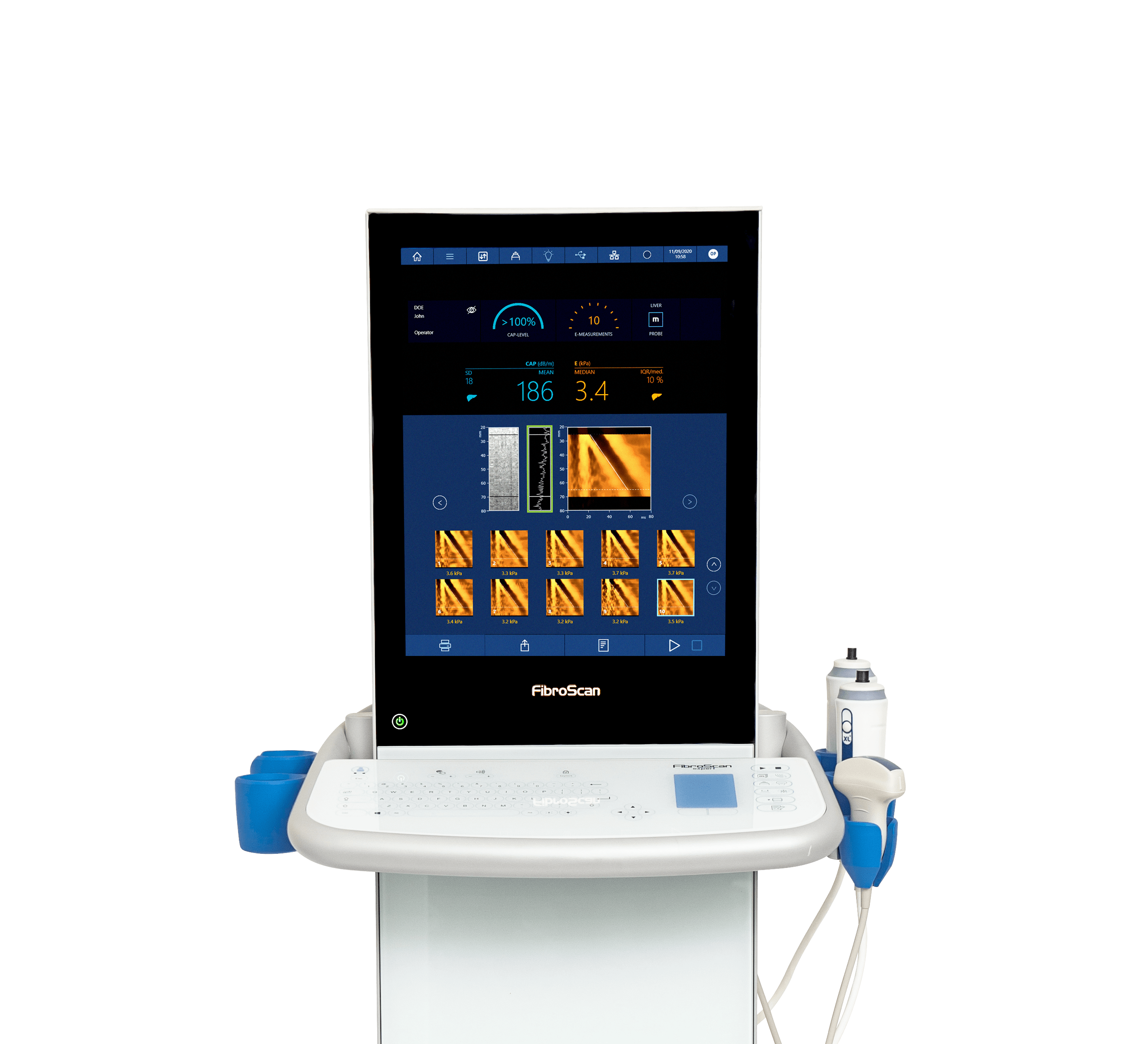 FibroScan® der nichtinvasive Goldstandard für Lebererkrankungen ECHOSENS